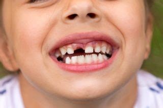 The average kitten has 26 baby teeth (deciduous teeth). Belastingdienst onderzoekt handel in melktanden - Nieuwspaal