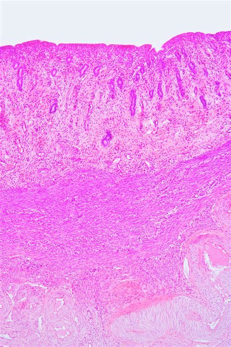 Cross Section Of Human Vagina Lm Photograph By Science Stock