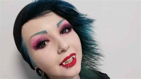Woman Gets Permanent Vampire Fangs Fitted After Becoming Fascinated