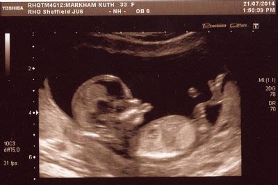 The person performing the scan is. Personal | Hacking for Christ