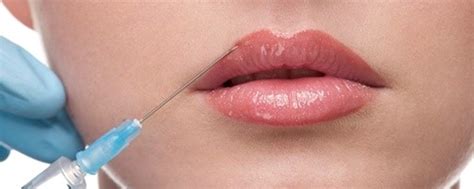 Lip Enhancement With Dermal Fillers Facethetics Training