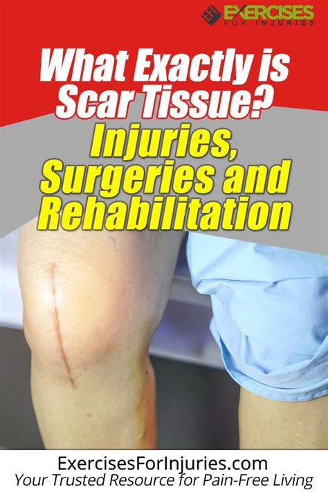 Scar Tissue Injuries Surgeries And Rehabilitation Exercises For