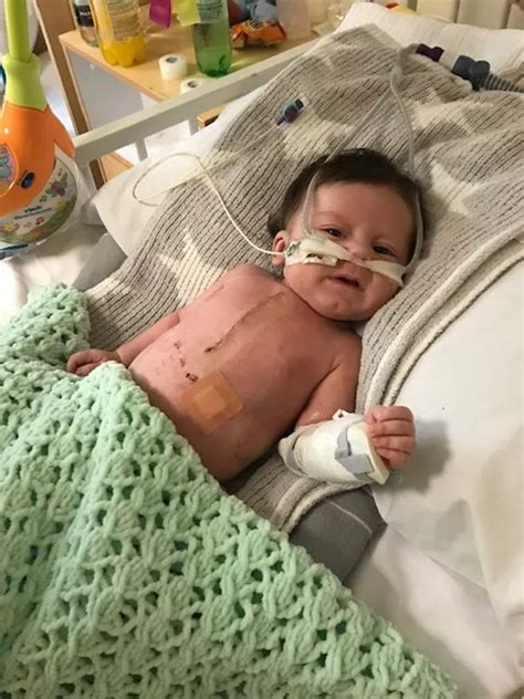 Mum Hails Miracle Cream That Cleared Baby Boy S Huge Open Heart