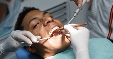 Scaling And Polishing Best Dental Clinic In Lagos Best Dentist In Lagos