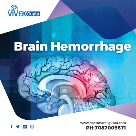 Best Brain Hemorrhage Treatment In Mohali Dr Vivek Gupta