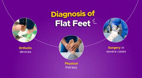 Flat Feet Causes And Symptoms Myfrido