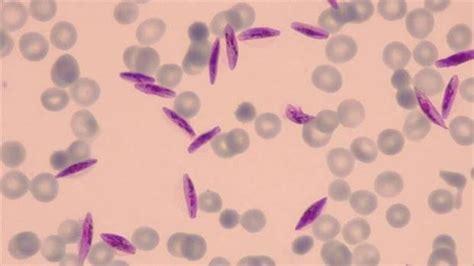 Hallada La Manera De Eliminar Un Elemento Clave De La Malaria Invdes