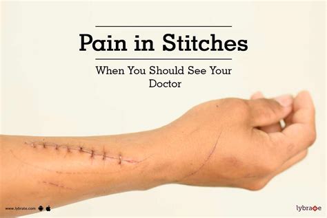 Pain In Stitches When You Should See Your Doctor By Dr Kanwaljit