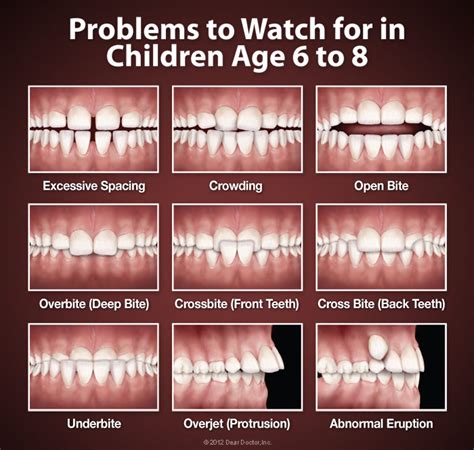 When To See An Orthodontist Dr Jeri Stull Orthodontics Fort Thomas Ky