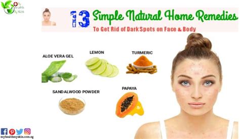 16 Home Remedies To Get Rid Of Itchy Skin