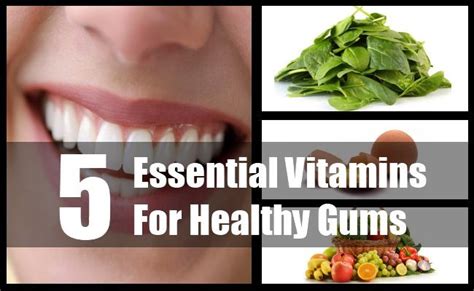 Vitamins For Healthy Gums Vitamins Healthy Gum