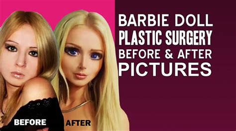 Top Barbie Doll Plastic Surgery Before And After Pics