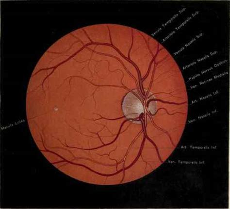 The Eyeball And Optic Nerve Part 4