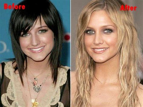Ashlee Simpson Plastic Surgery Before And After Hair Implants Celebrity Surgery Nose Job