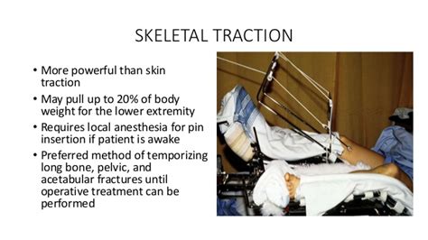 A traction splint utilizes straps that wrap over the pelvic region while restraining the hip and supporting the leg and hip with a metallic rod by depicting normal bone functionality. Splints and Tractions