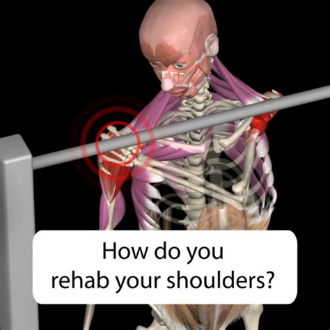 Managing Rotator Cuff Related Shoulder Pain Muscleandmotion Strength