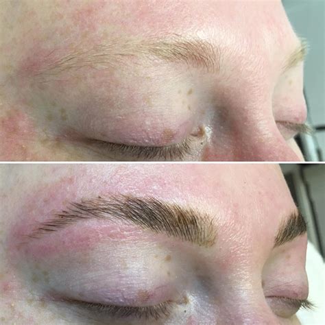 Brow Lamination Before And After 2 Dérmica Medesthetics