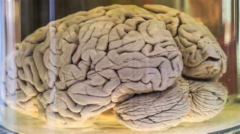 Why Do Our Brains Have Folds Live Science