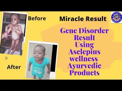 Gene Disorder Result Gene Disorder Result By Awpl Products Awpl