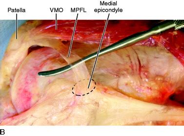 Medial and Anterior Knee Anatomy | Musculoskeletal Key