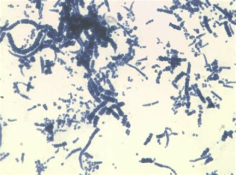 Gram Stain With Characteristic Branching Filaments With Train Track