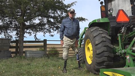 Keezletown Man Hopes To Prevent Farming Accidents After His Own Experience