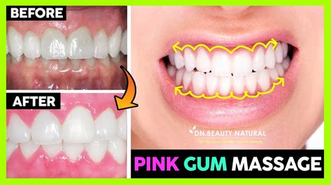 😁 How To Get Pink Gums With Massage Black Gums To Pink Gums Healthy