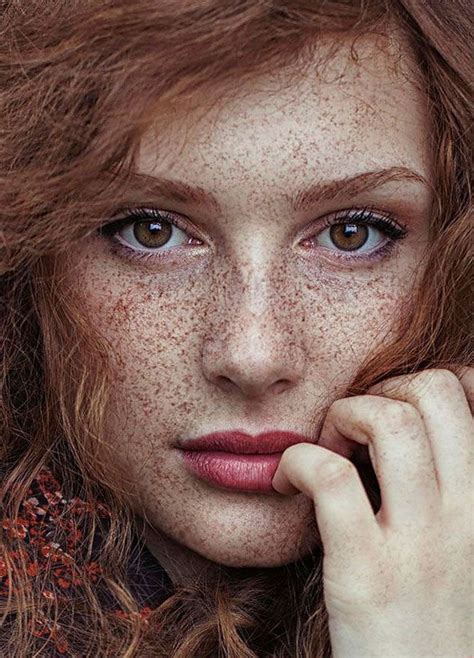 Freckled People Wholl Hypnotize You With Their Unique Beauty