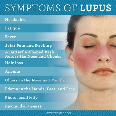 Reverse The Symptoms Of Lupus Naturally Amy Myers Md Systemic