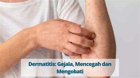 Dermatitis Definisi Penyebab Jenis Patofisiologi Penatalaksanaan The