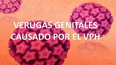 Verrugas Genitales Por El Vph Jeancarlo M Udocz