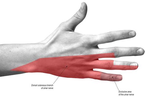 Pin On Hand Therapy