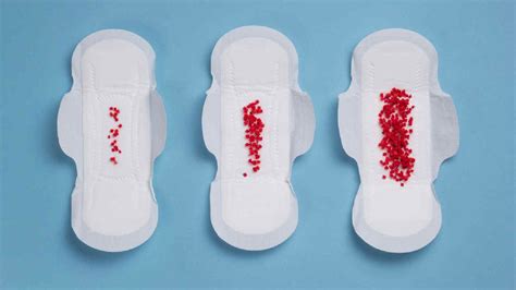 Implantation Bleeding How To Differentiate It From Your Periods The