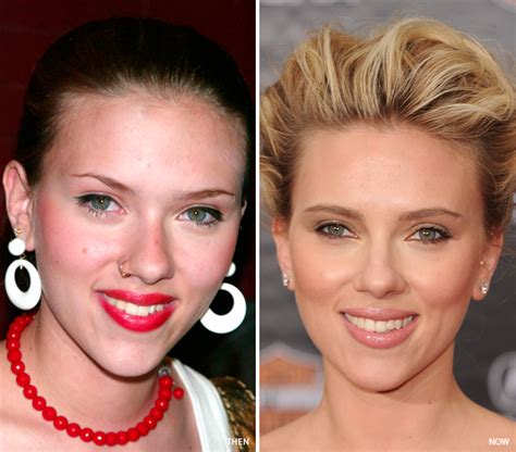 Scarlett Johansson Before And After Breast Implants