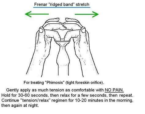 Tight Foreskin Or Short Frenulum Penis Disorders Mens Health Community Patient