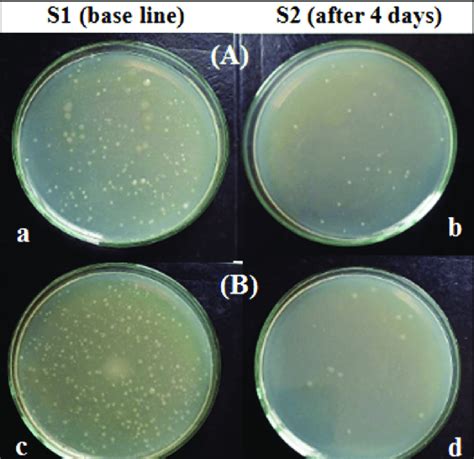 Plate Count Agar Media Showing Colony Forming Units Total Bacterial