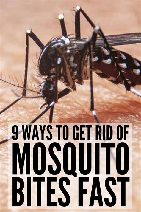 Stop The Itch 9 Natural Mosquito Bite Remedies That Work In 2023