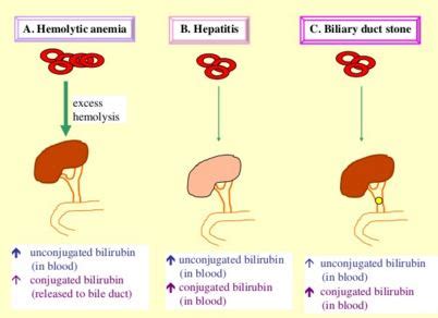 Learn why you might need the test and what your doctor can learn from the results. Bilirubin Formation and Excretion - websitereports243.web ...