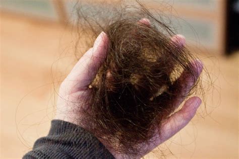 Reasons And Remedies For Excessive Hair Loss Indian Beauty Tips