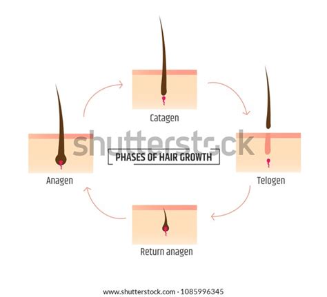 Hair Growth Phases Infographics Trichology Dermatology Stock Vector