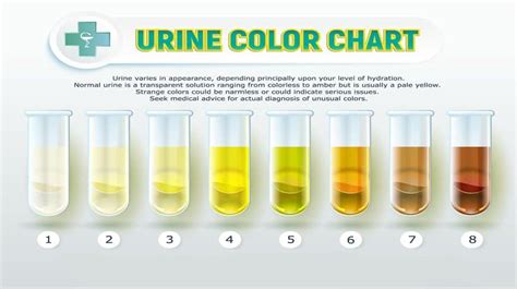 Pregnancy Urine Color Chart Hans Silverman Light Green Discharge