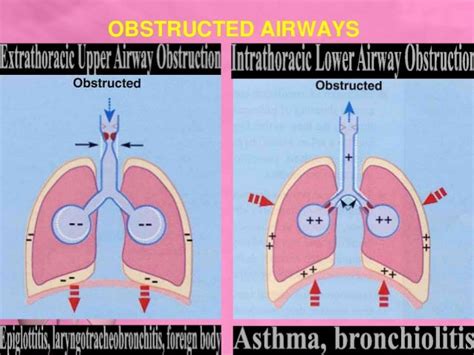 Upper And Lower Airway Obstruction