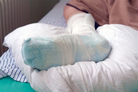 Man In Hospital Broken Leg