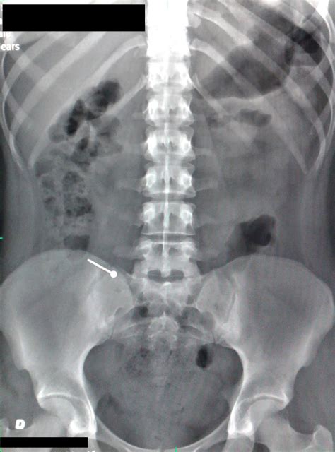 Dicas De Radiologia Tudo Sobre Radiologia Imagens Radiol Gicas Radiografia Mostrando Corpo