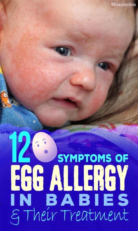 Can Egg Allergy Cause Skin Rash Sharron Hoover