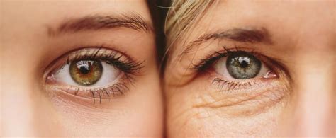 the aging eye the canadian association of optometrists