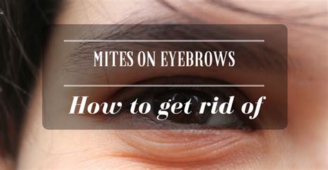 Microscopic Eyebrow Mites Eyebrows Idea