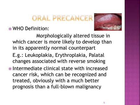 Definition Of Oral Cancer Doctor Heck