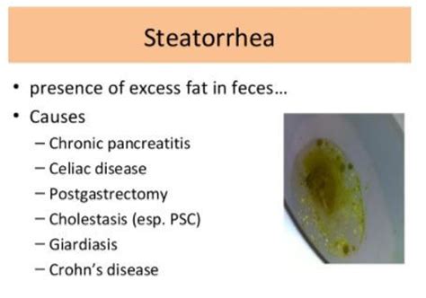 As the cancer grows it can start to cause symptoms. Steatorrhea - Medical Definition, What is?, Symptoms ...