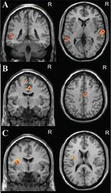 Photos of Mri Anxiety Treatment